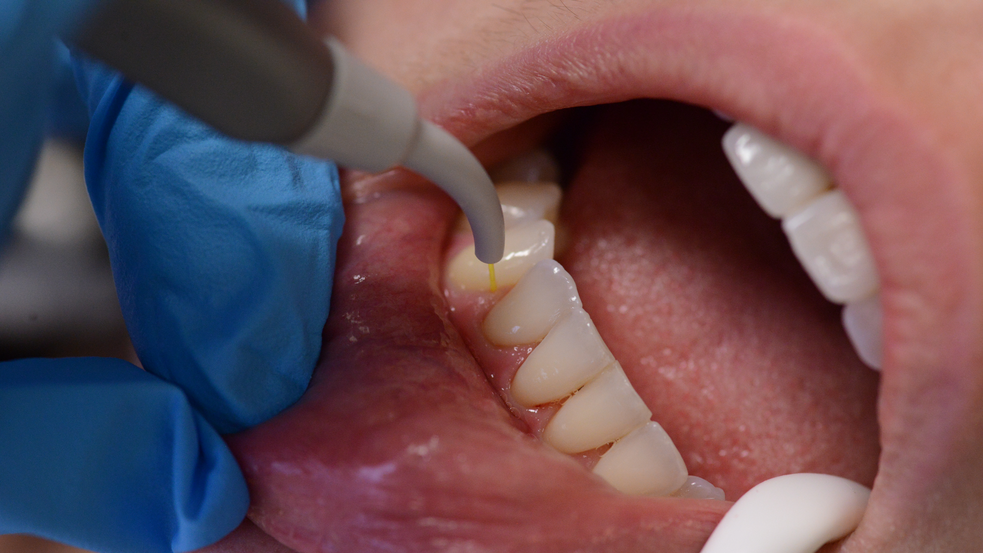 2010 Rd Hdan P08 5f9833f20ac8f