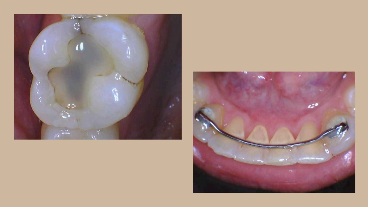 Mouthwatch Metro Sanchez