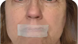 What mouth taping may look like. What mouth taping may look like.