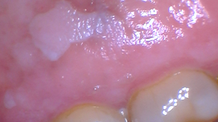 2108 Rd Hbur P01 60e8ad220a371 611d6b4b2c4e8