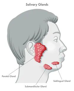 Figure 1: The partoid, submandibular, and sublingual glands produce saliva. Figure 1: The partoid, submandibular, and sublingual glands produce saliva.