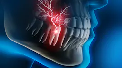 Getty Images 1158385795 62e828d240b40 Getty Images 1158385795 62e828d240b40