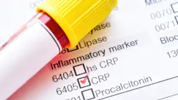 Getty Images 1004935702 63c9a3c01746d Getty Images 1004935702 63c9a3c01746d