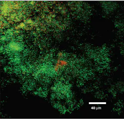 Figure 6a: Streptococcus mutans exposed to Perio Gel: live cells Figure 6a: Streptococcus mutans exposed to Perio Gel: live cells