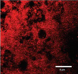 Figure 6b: Streptococcus mutans exposed to Perio Gel: dead cells Figure 6b: Streptococcus mutans exposed to Perio Gel: dead cells