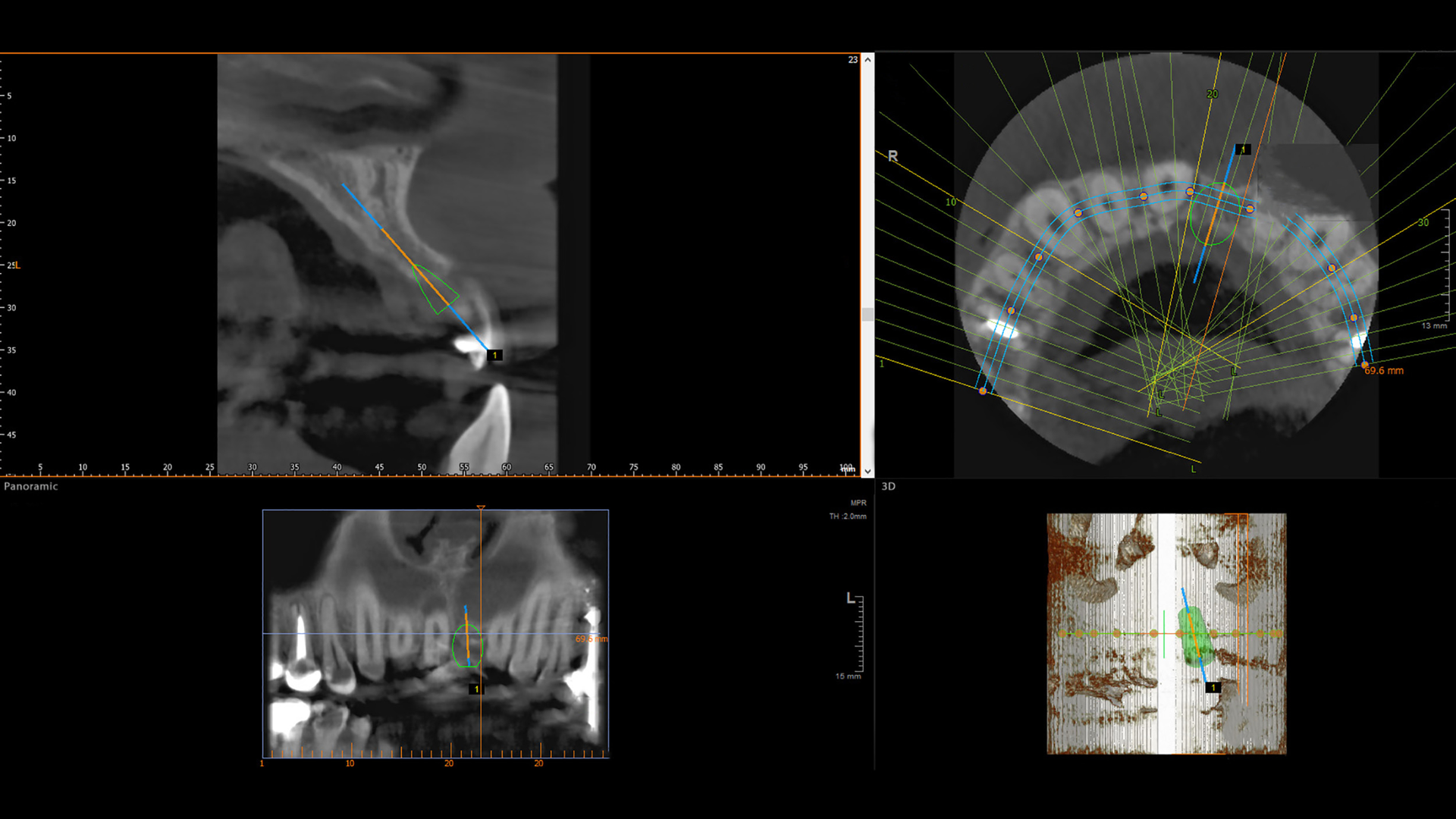 Dreamstime Xl 115254632 64d10cbdbb960