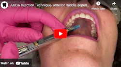 Anterior Middle Superior Alveolar Amsa Nerve Block Anterior Middle Superior Alveolar Amsa Nerve Block