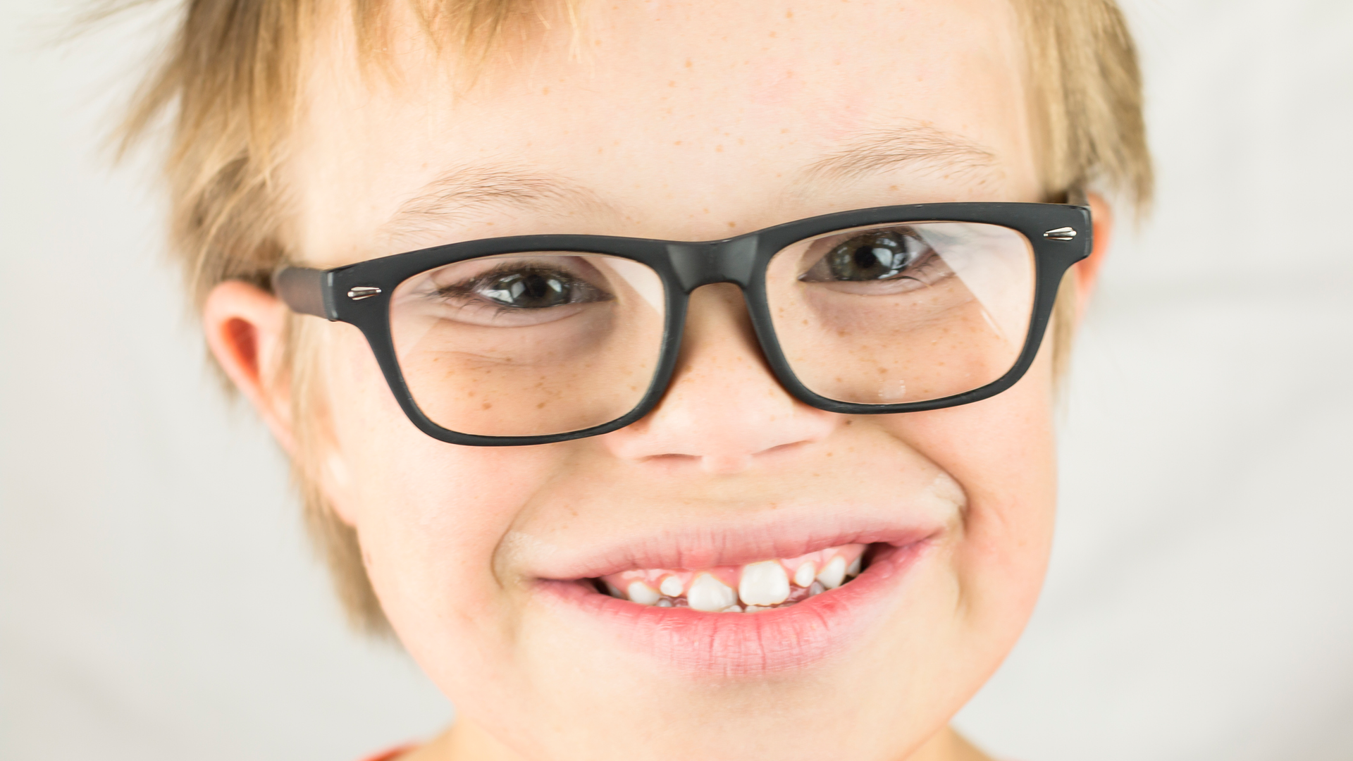 Down Sydrome Dental Patient