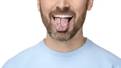 656f2c430cd4bd001ebb6512 Dreamstime Xxl 282565153 656f2c430cd4bd001ebb6512 Dreamstime Xxl 282565153