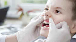 Children can develop gum disease too. Children can develop gum disease too.