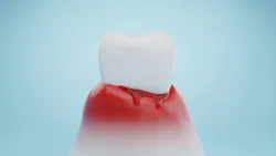 65e896cf8e9786001eaa3607 Gettyimages1434356513 65e896cf8e9786001eaa3607 Gettyimages1434356513