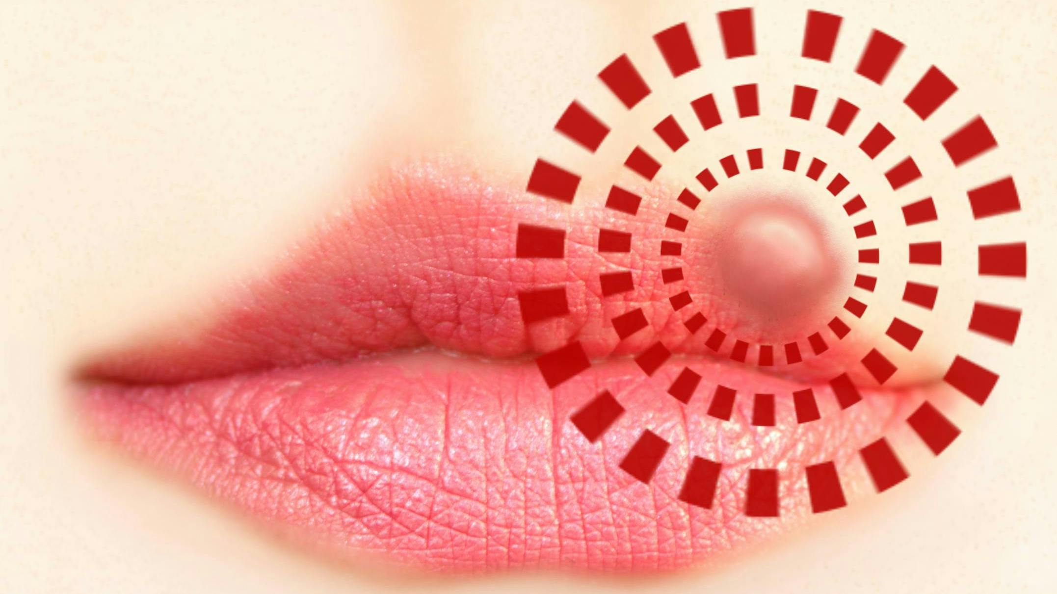 cold sores and infection control in the dental office.