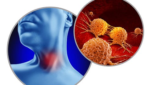 6616b8b919778b001e8f0a4a Gettyimages1652155881170667a