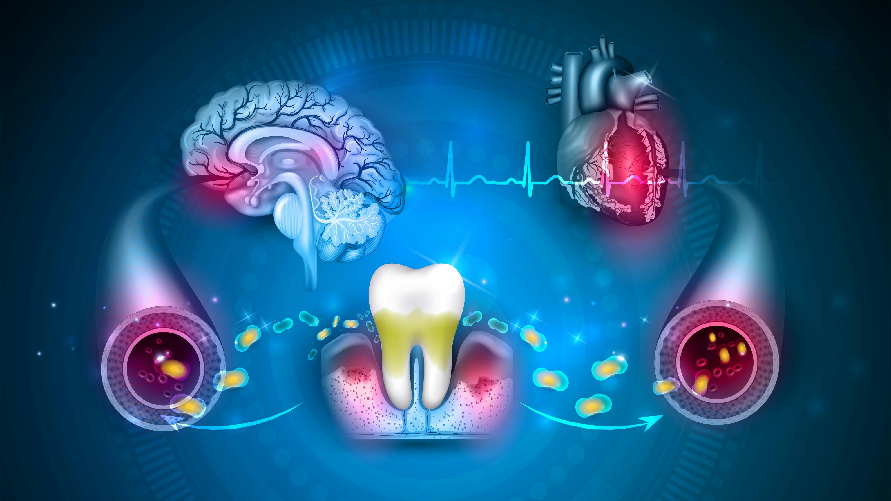 oral systemic disease