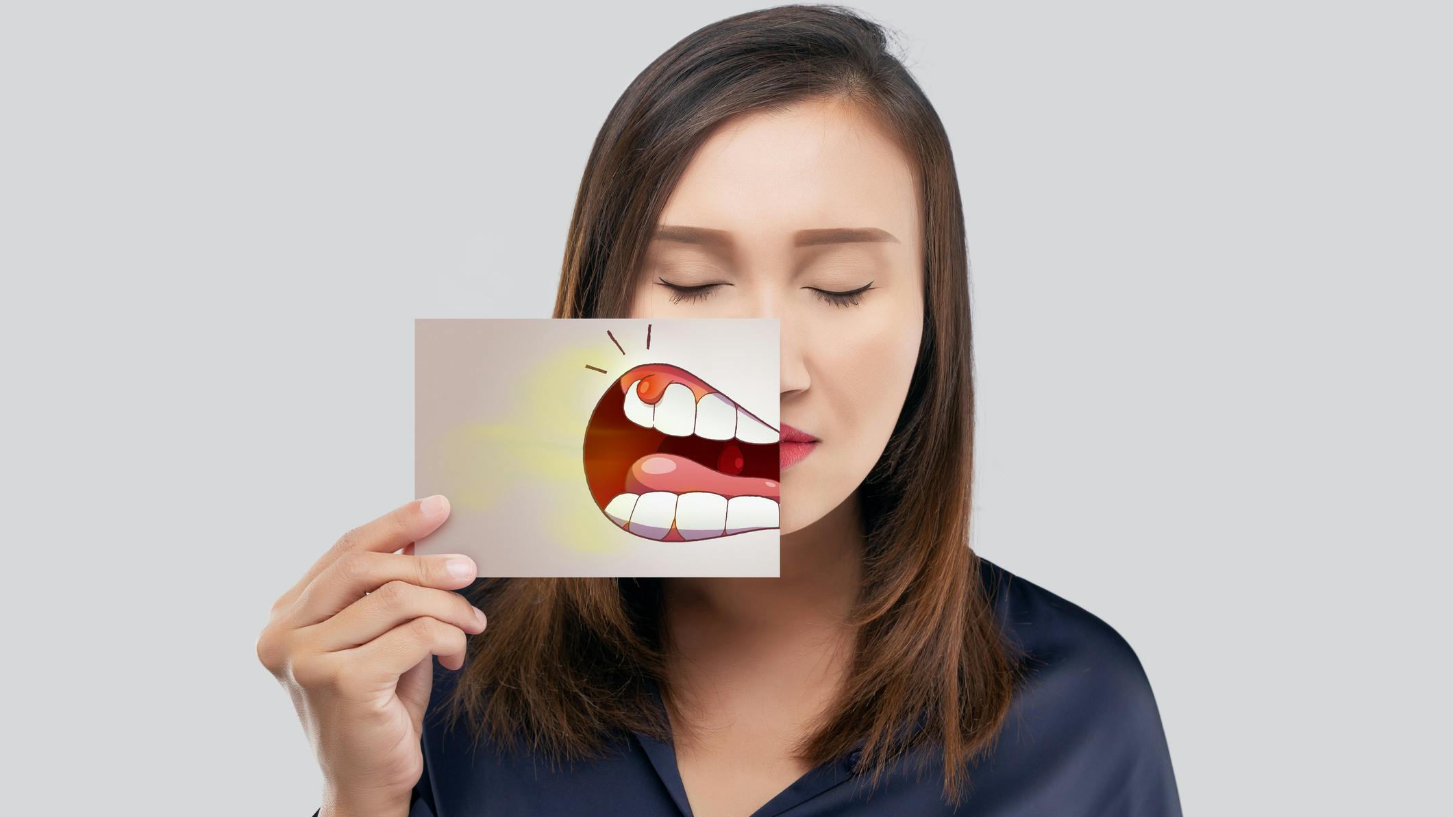 There's a new gel treatment for perio disease.