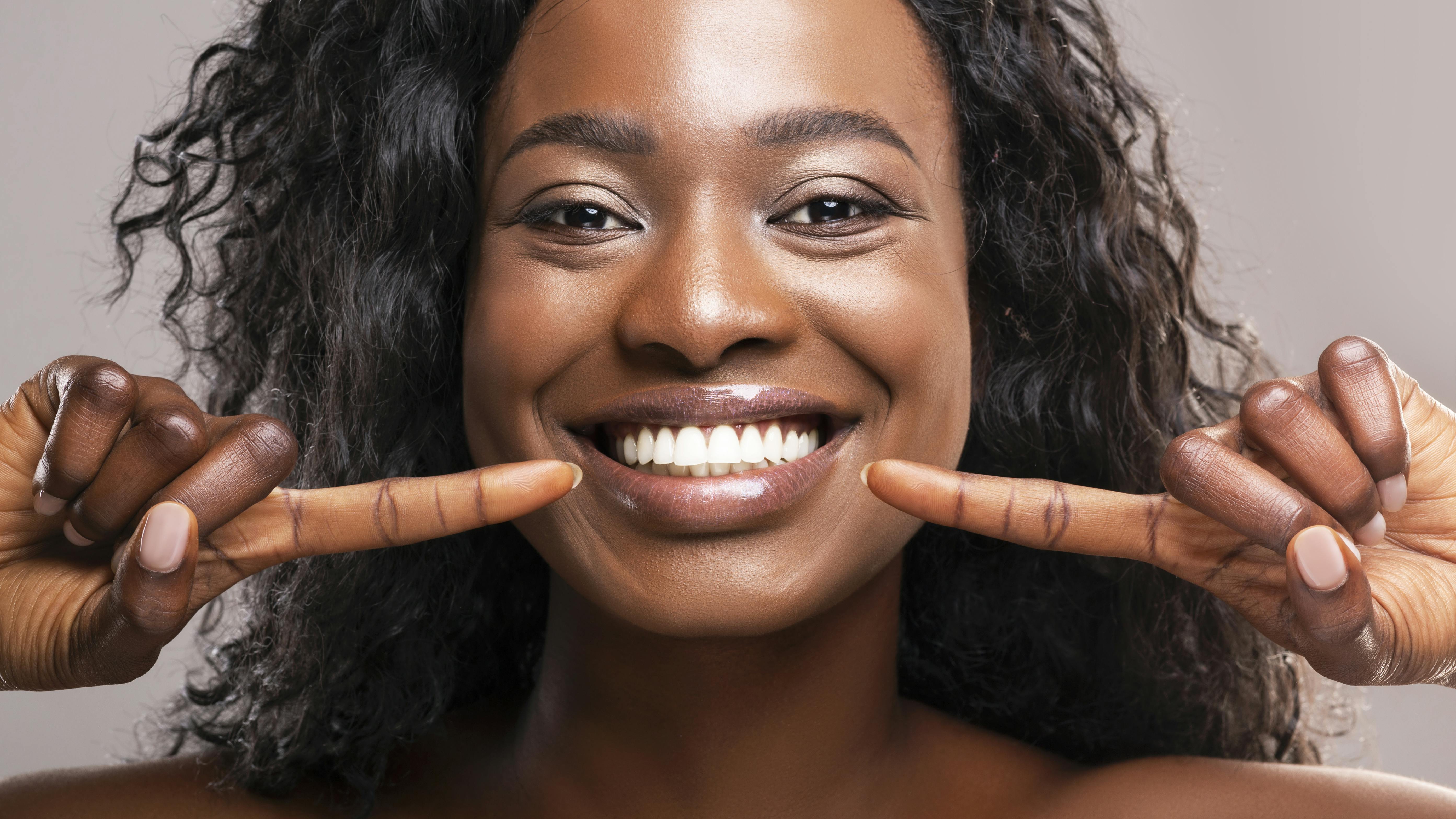 dental tooth whitening