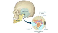 6772cb84afbd265500183096 Tmj Disorder 2 6772cb84afbd265500183096 Tmj Disorder 2