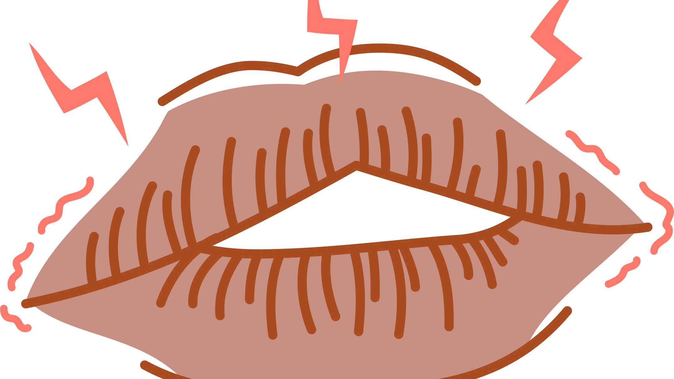 dry_mouth_xerostomia