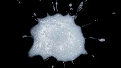 spot of saliva spot of saliva