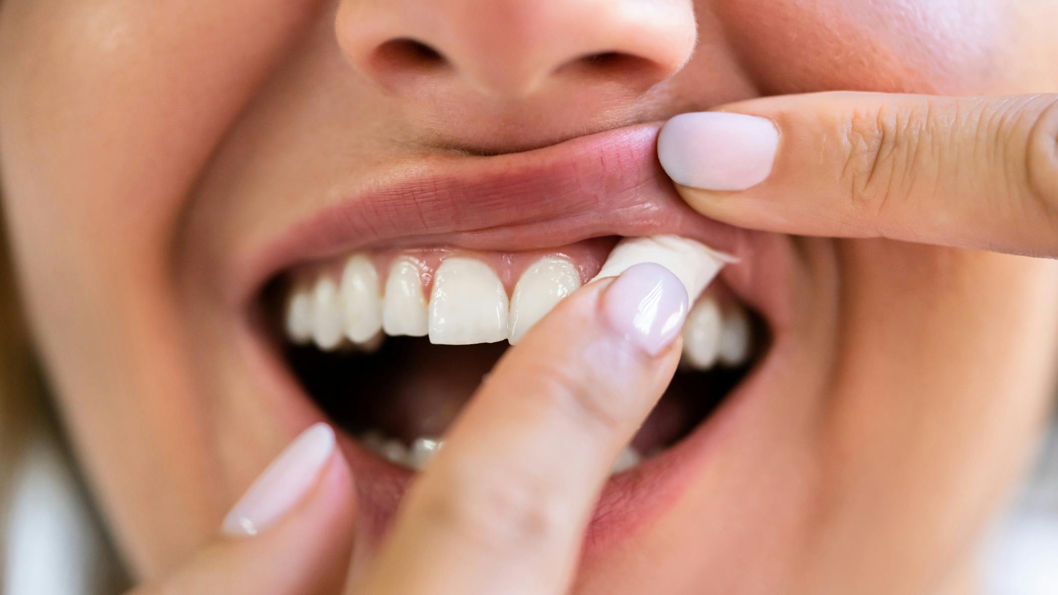 woman-placing-nicotine-pouch-between-gums