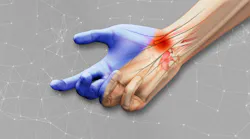 illustration-of-hand-in-pain illustration-of-hand-in-pain