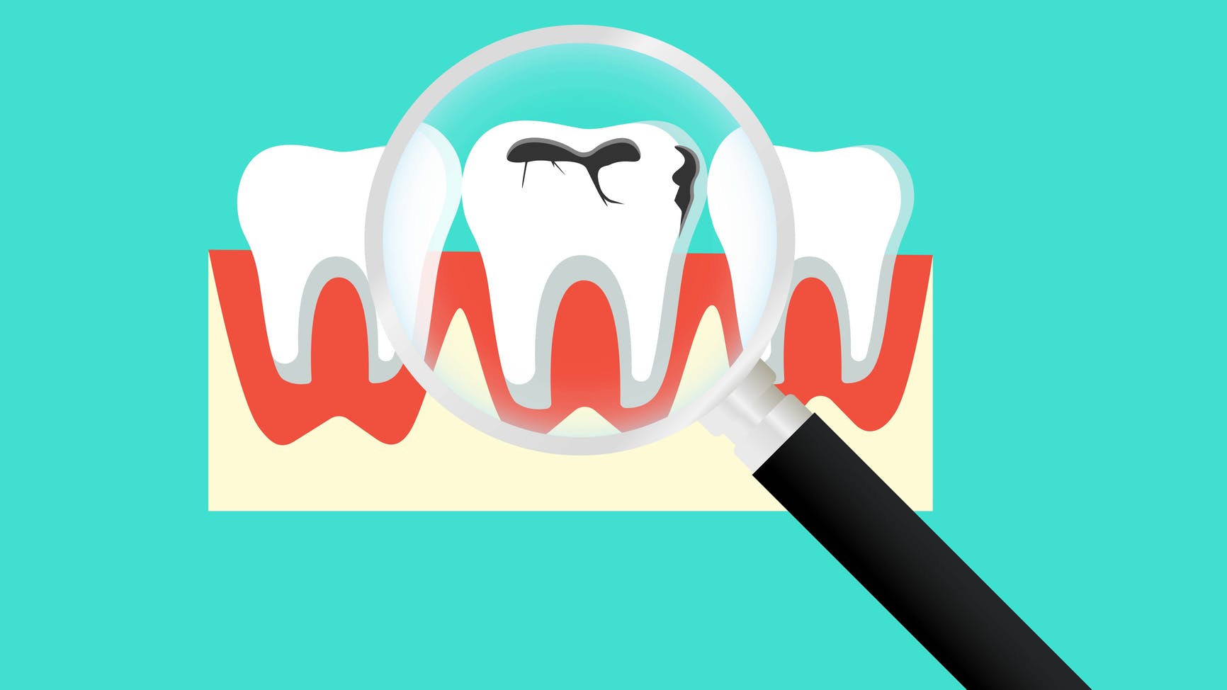 Incorporate remineralization strategies into your clinic protocols