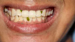 6890e7b89026d57fcceb651f Gettyimages1280468056 6890e7b89026d57fcceb651f Gettyimages1280468056