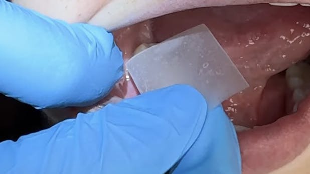 Dental hygiensits pride themselves in prevention.