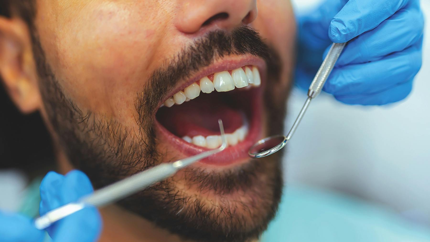 man getting a dental examination
