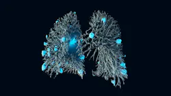 Fraun_Lung_Prom Fraun_Lung_Prom