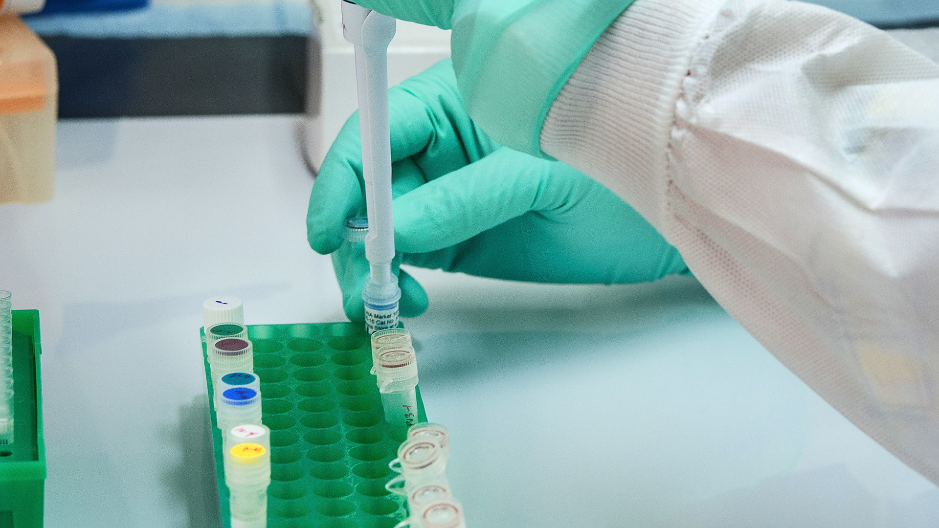 Cdc W Dx Fn D Bec0 Unsplash 60c0e54835205