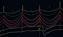 Tdworld Com Sites Tdworld com Files Uploads 2016 10 13 Photo2 Argenta Palisades Profilefinal Tdworld Com Sites Tdworld com Files Uploads 2016 10 13 Photo2 Argenta Palisades Profilefinal