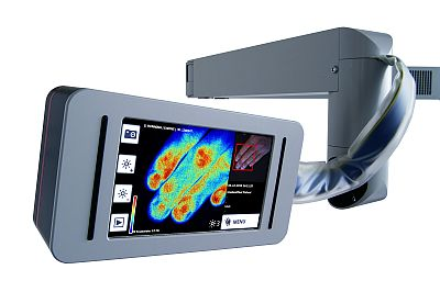 Laser-based imager determines severity of burns