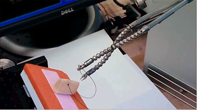 3-D vision system automatically tracks anatomical structures