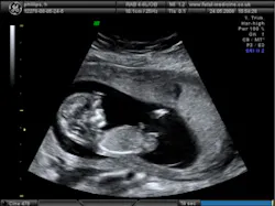 3-D ultrasound software company spins out of Oxford 3-D ultrasound software company spins out of Oxford