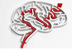 Software automates brain image analysis Software automates brain image analysis