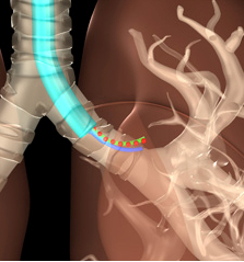 New software keeps X-ray exposure down