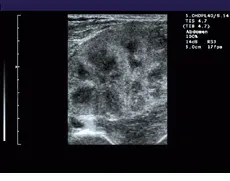 Th Vsd51083 21 Th Vsd51083 21