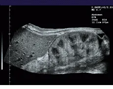 Th Vsd51083 22 Th Vsd51083 22