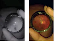 1804vsdisp P04 1804vsdisp P04