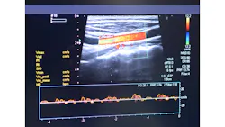 3 D Imaging Ultrasound Vascular 616853a7a149a 3 D Imaging Ultrasound Vascular 616853a7a149a