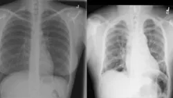 Medical Imaging Normal And Anomaly 6181942031596 Medical Imaging Normal And Anomaly 6181942031596