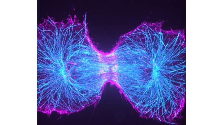 Dividing cell imaged on a spinning disc microscope using a Teledyne Photometrics camera. Shown is a genome-edited cell expressing SEPT2-GFP (magenta) from the endogenous locus that is immune-stained for tubulin (teal). Acquired by Prof. Helge Ewers, Freie Universit&auml;t Berlin, Germany.