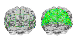 Figure 2: At left, a typical optical fiber array consisting of 10 source and 10 detector locations is arranged in a grid design to provide 30 functional NIR spectroscopy channels—all separated by 30 mm. On the right is the 12-tile LUMO prefrontal array that provides more than 400 functional NIR spectroscopy channels with separations in the range of 10 to 40 mm. LUMO provides an average cortical sensitivity of 100x that of traditional functional NIR spectroscopy. Figure 2: At left, a typical optical fiber array consisting of 10 source and 10 detector locations is arranged in a grid design to provide 30 functional NIR spectroscopy channels—all separated by 30 mm. On the right is the 12-tile LUMO prefrontal array that provides more than 400 functional NIR spectroscopy channels with separations in the range of 10 to 40 mm. LUMO provides an average cortical sensitivity of 100x that of traditional functional NIR spectroscopy.
