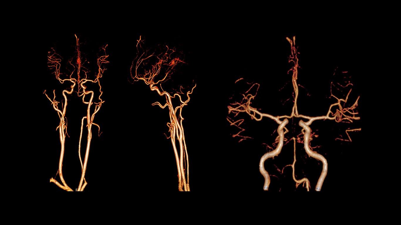 dreamstime_xxl_154454133