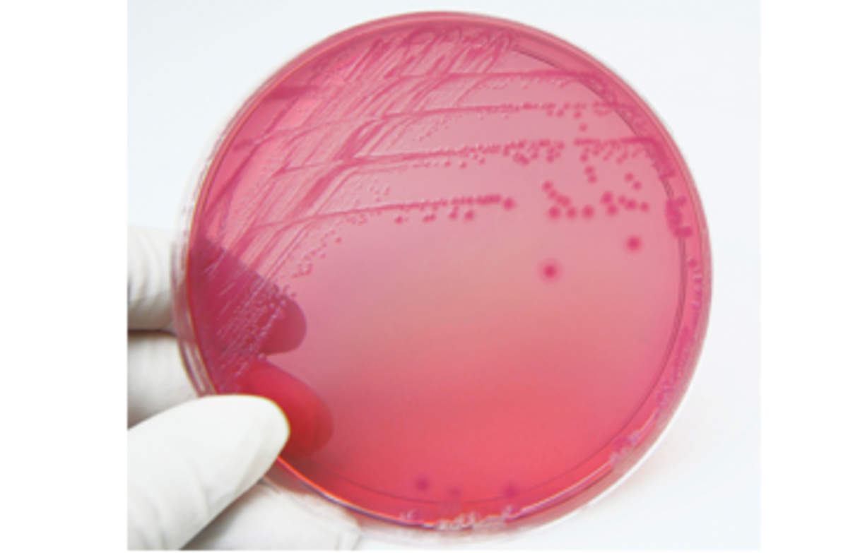 Contaminant of the Month: Coliform Bacteria | Water Tech Online