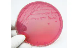 Linde Stewart/Thinkstock Linde Stewart/Thinkstock