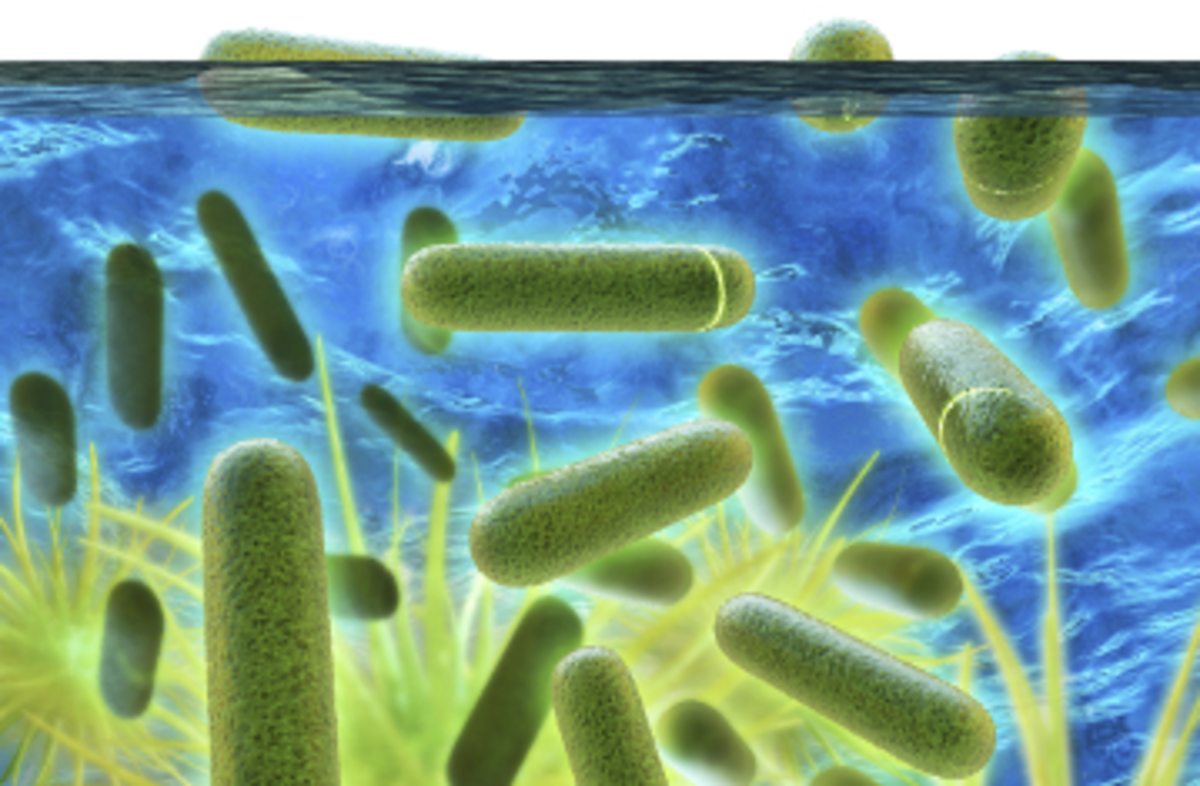 Treating legionella outbreaks in water systems Water Tech Online