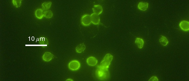 Cryptosporidium Parvum 01