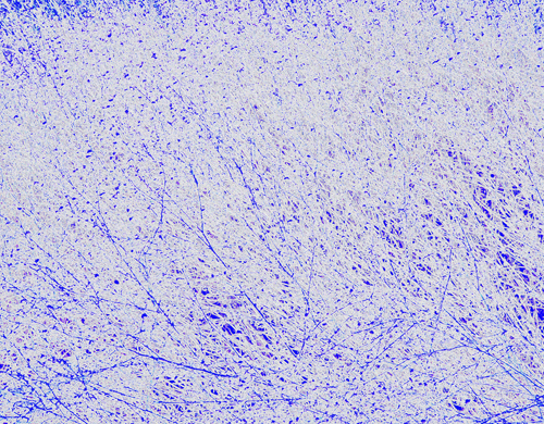 Content Dam Ww Online Articles 2018 09 Membrane Blue